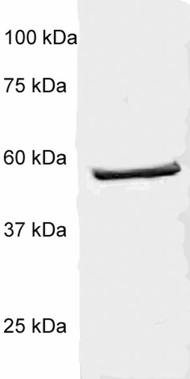 p56-LCK (LSK) Antibody in Western Blot (WB)