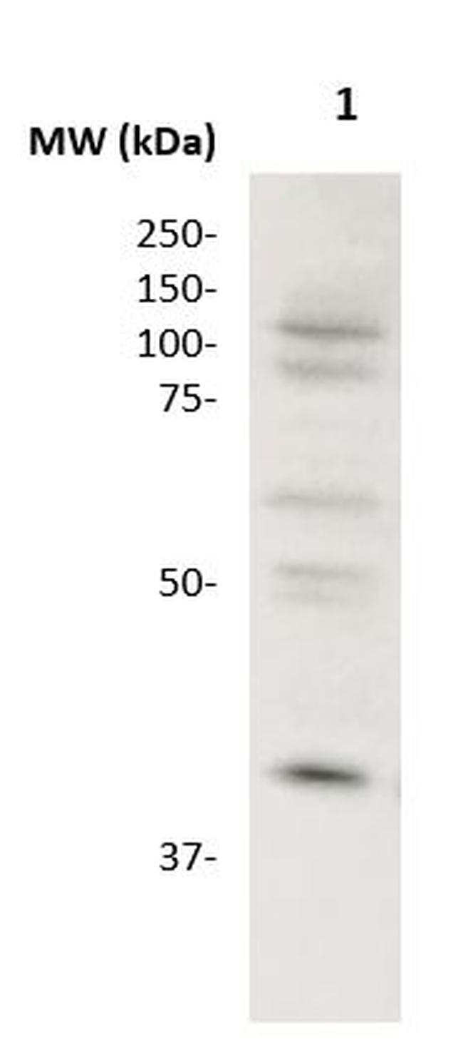 CCR1 Antibody in Western Blot (WB)