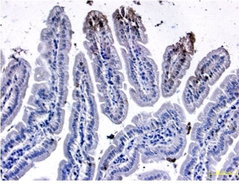 FOXP1 Antibody in Immunohistochemistry (Paraffin) (IHC (P))
