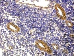 FOXP3 Antibody in Immunohistochemistry (Paraffin) (IHC (P))