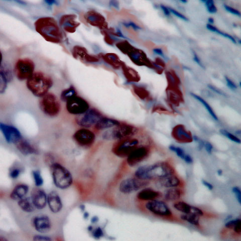 Mammaglobin Antibody in Immunohistochemistry (PFA fixed) (IHC (PFA))