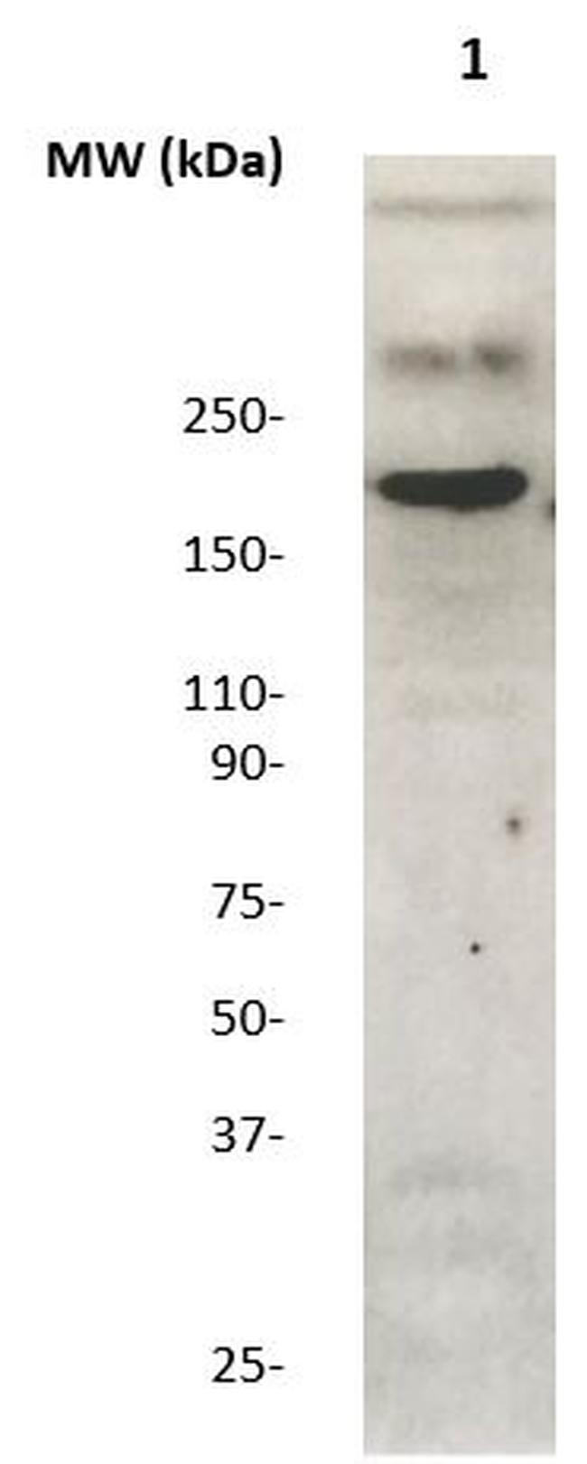 C-erbB3/HER3 Antibody in Western Blot (WB)