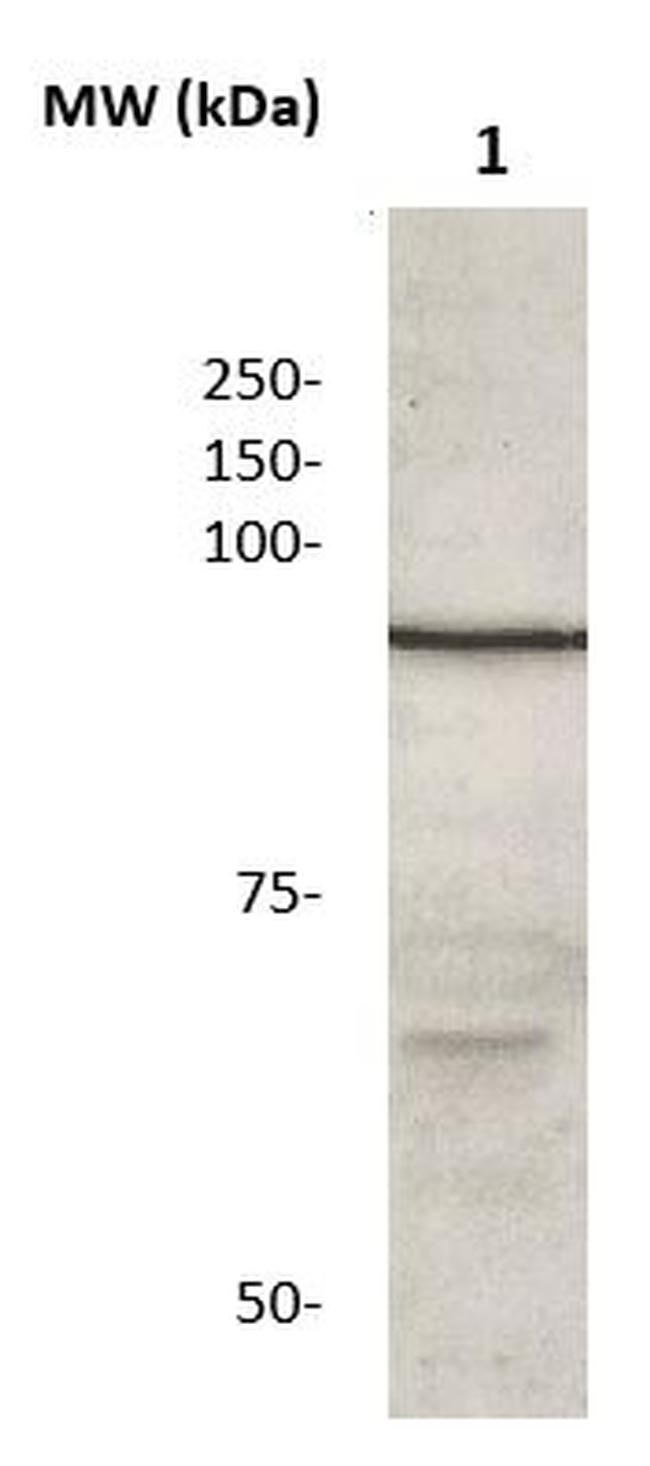 Catenin-beta Antibody in Western Blot (WB)