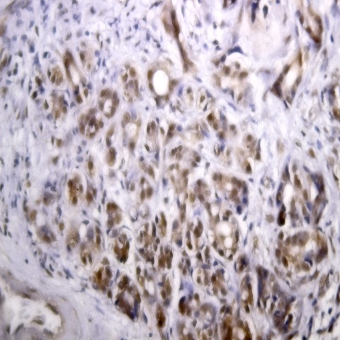 IRS-1 Antibody in Immunohistochemistry (Paraffin) (IHC (P))