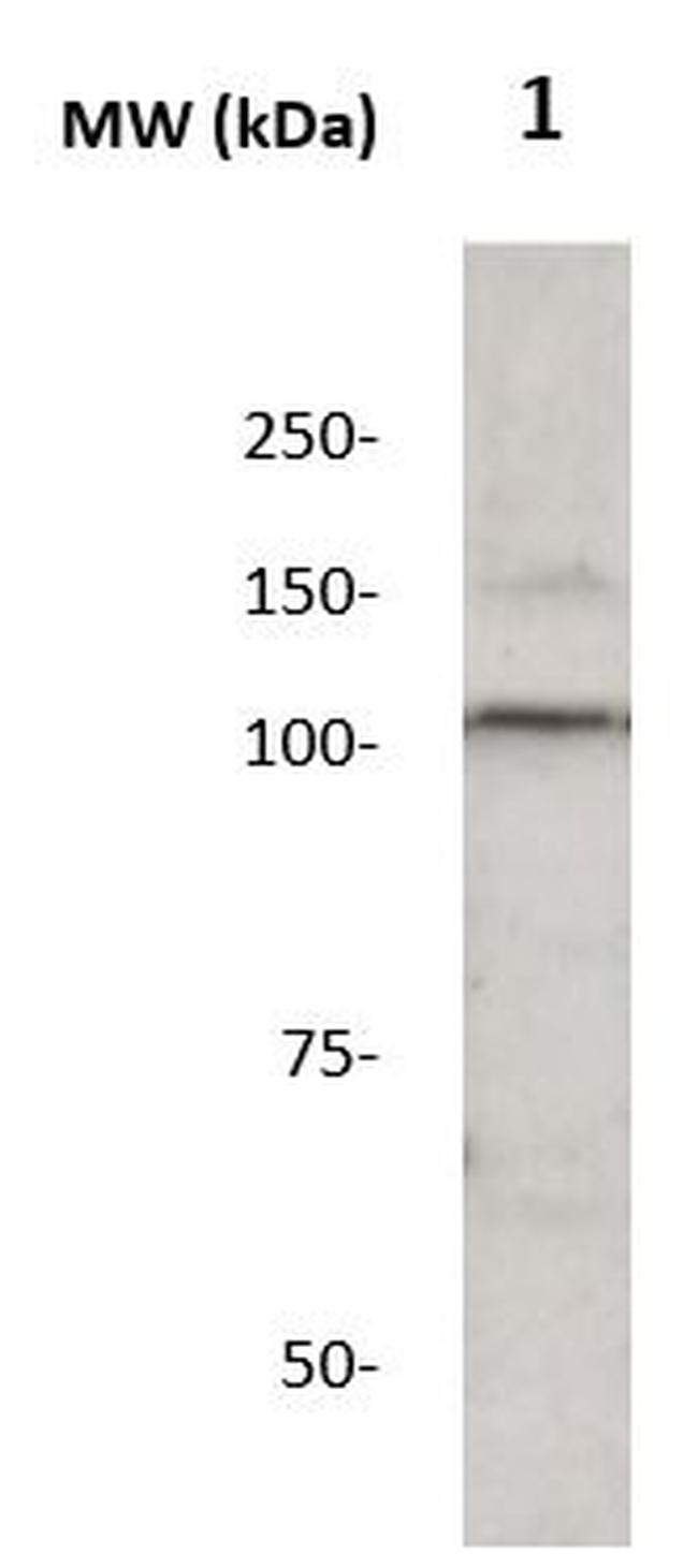 Corin Antibody in Western Blot (WB)