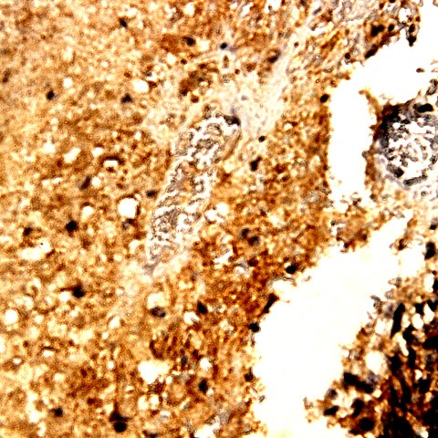 MMP-13 Antibody in Immunohistochemistry (Paraffin) (IHC (P))