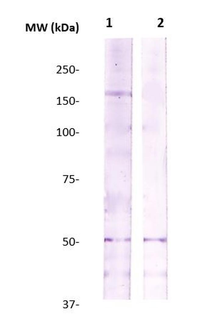Rho Kinase/ROCKII Antibody in Western Blot (WB)