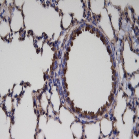 ER81 Antibody in Immunohistochemistry (Paraffin) (IHC (P))