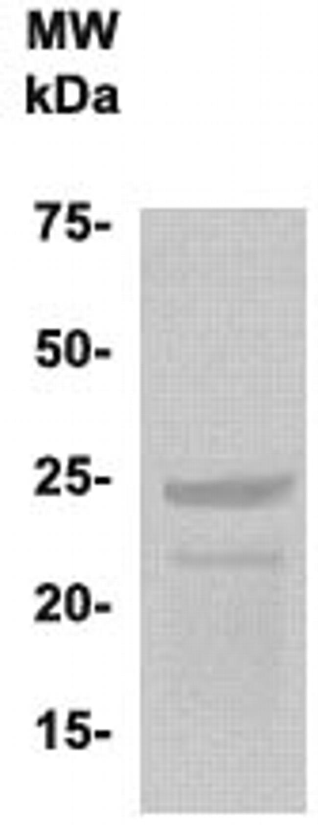 Phospho-PLAC1 (Ser121, Tyr147, Ser156) Antibody in Western Blot (WB)