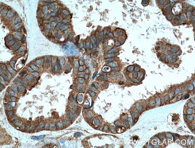 TRIP6 Antibody in Immunohistochemistry (Paraffin) (IHC (P))