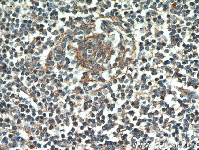 CD23 Antibody in Immunohistochemistry (Paraffin) (IHC (P))