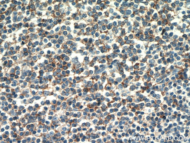 CD23 Antibody in Immunohistochemistry (Paraffin) (IHC (P))