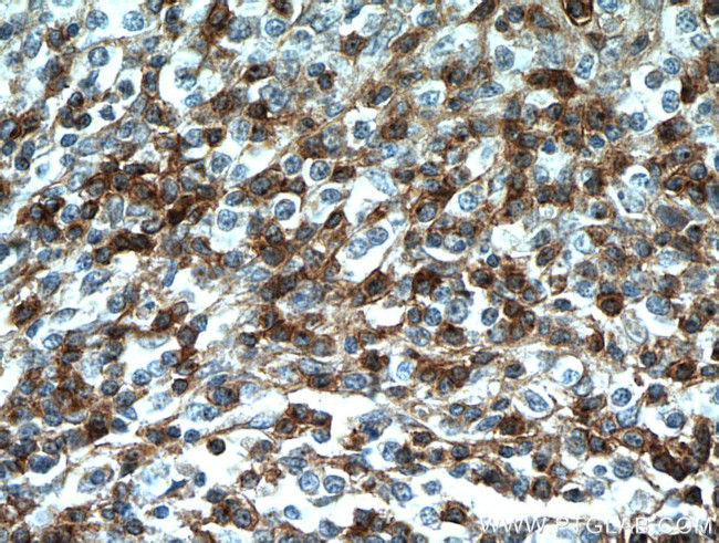 CD7 Antibody in Immunohistochemistry (Paraffin) (IHC (P))