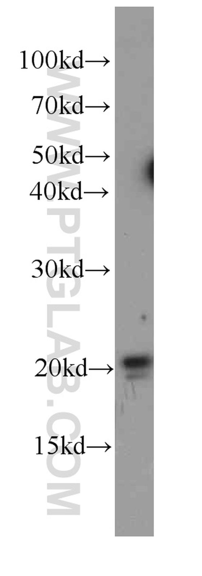 P21 Antibody in Western Blot (WB)