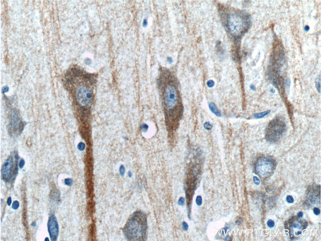 CHRNA7 Antibody in Immunohistochemistry (Paraffin) (IHC (P))