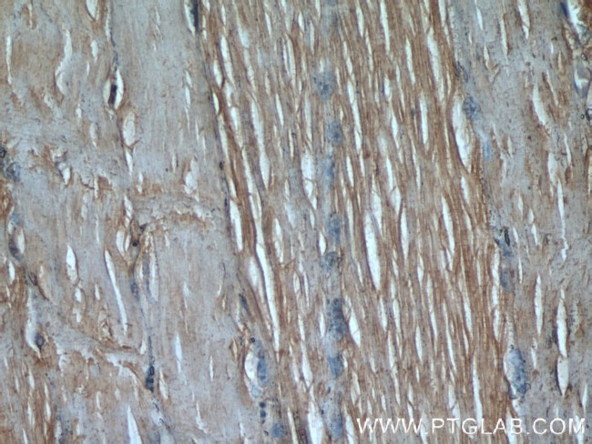 Desmin Antibody in Immunohistochemistry (Paraffin) (IHC (P))