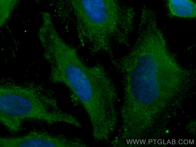 Cytoglobin Antibody in Immunocytochemistry (ICC/IF)