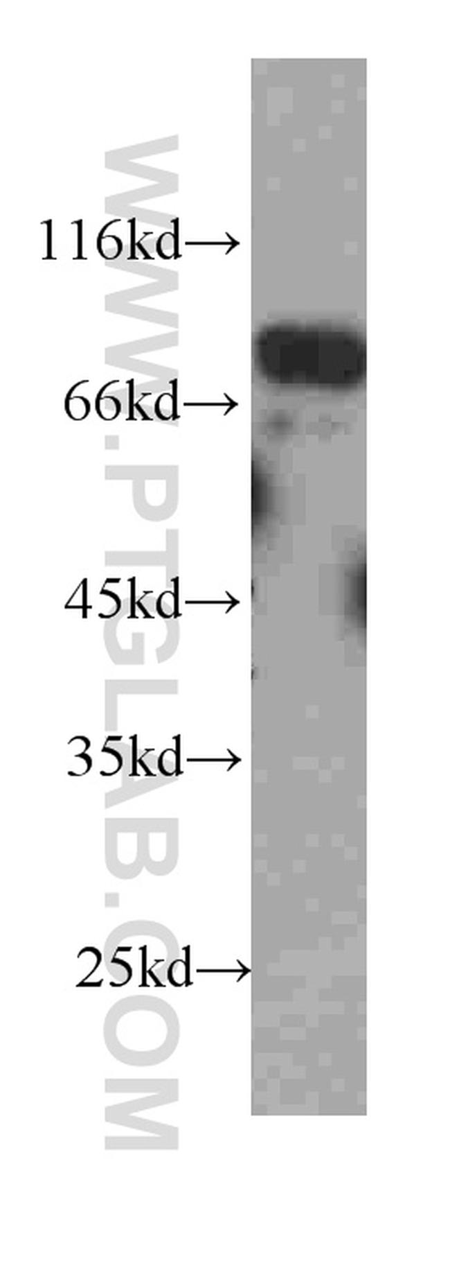 FAF1 Antibody in Western Blot (WB)