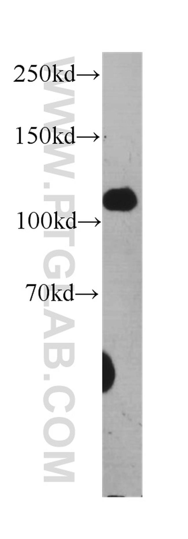 Desmocollin 2 Antibody in Western Blot (WB)