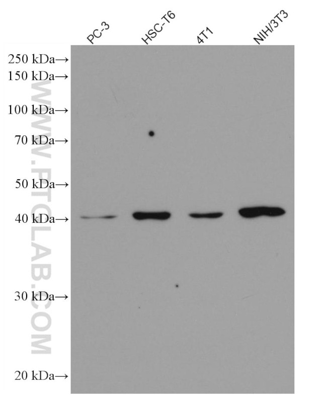 p504S/AMACR Antibody in Western Blot (WB)