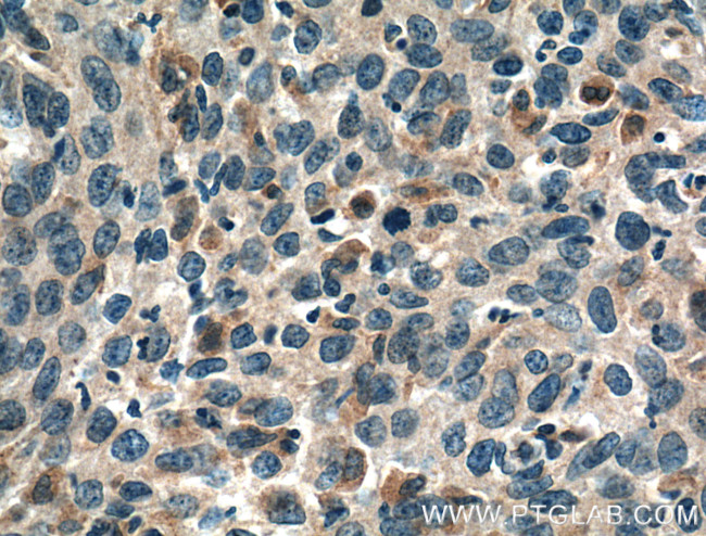 PGRMC2 Antibody in Immunohistochemistry (Paraffin) (IHC (P))