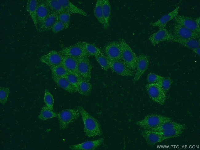 SMN-Exon7 Antibody in Immunocytochemistry (ICC/IF)