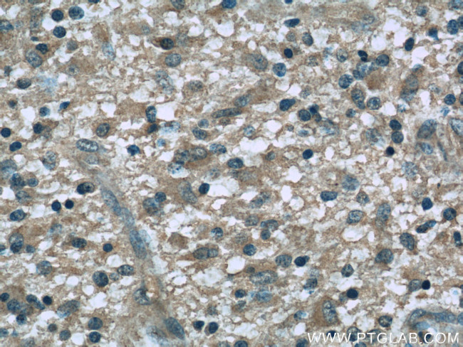 Dynamitin (1-401 AA) Antibody in Immunohistochemistry (Paraffin) (IHC (P))