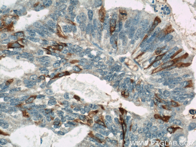 MUC16/CA125 Antibody in Immunohistochemistry (Paraffin) (IHC (P))