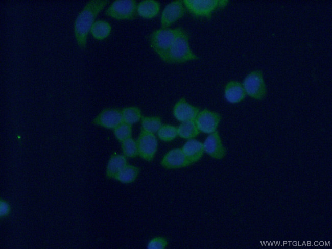 MEST Antibody in Immunocytochemistry (ICC/IF)