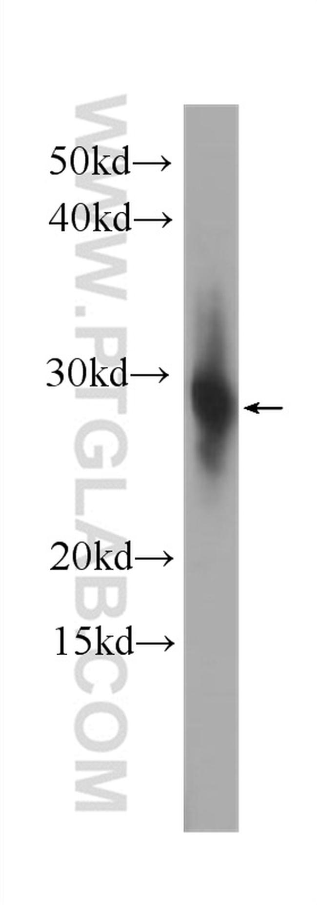 CRYBB1 Antibody in Western Blot (WB)
