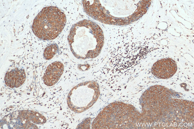 SECTM1 Antibody in Immunohistochemistry (Paraffin) (IHC (P))