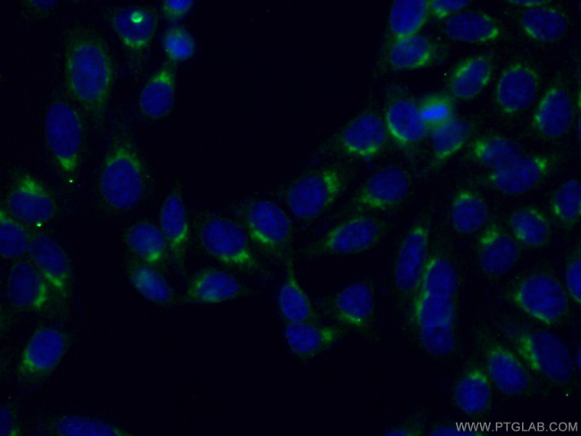 FAM3C Antibody in Immunocytochemistry (ICC/IF)
