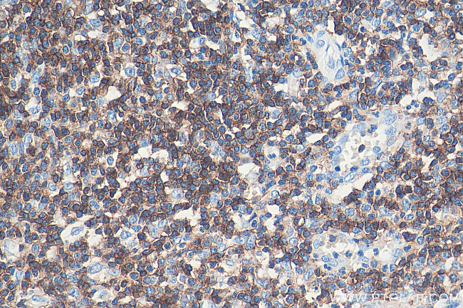 CD45 Antibody in Immunohistochemistry (Paraffin) (IHC (P))