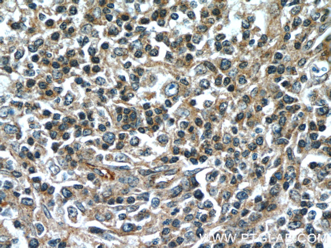 SCGF Antibody in Immunohistochemistry (Paraffin) (IHC (P))