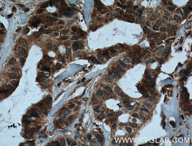 IL37 Antibody in Immunohistochemistry (Paraffin) (IHC (P))