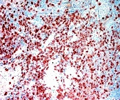 CD8 Antibody in Immunohistochemistry (Paraffin) (IHC (P))
