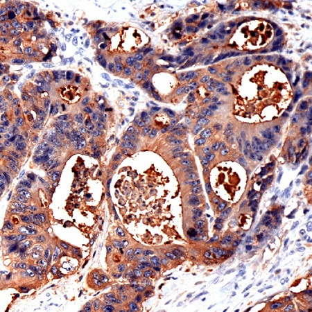 CEA Antibody in Immunohistochemistry (Paraffin) (IHC (P))