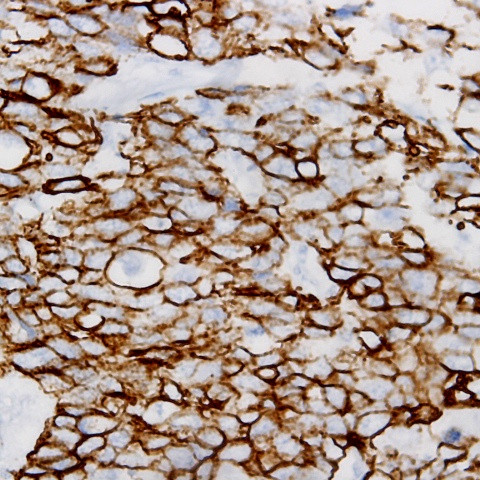 Beta-Tubulin III Antibody in Immunohistochemistry (Paraffin) (IHC (P))
