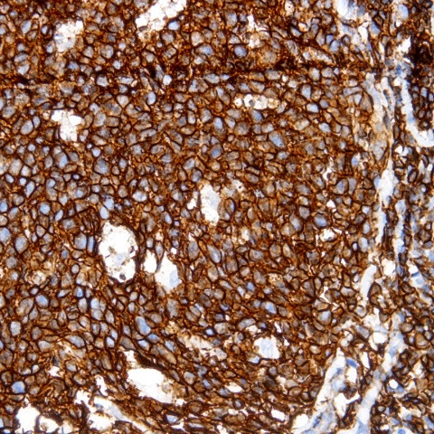 CD45 (Leukocyte common antigen, LCA) Antibody in Immunohistochemistry (Paraffin) (IHC (P))