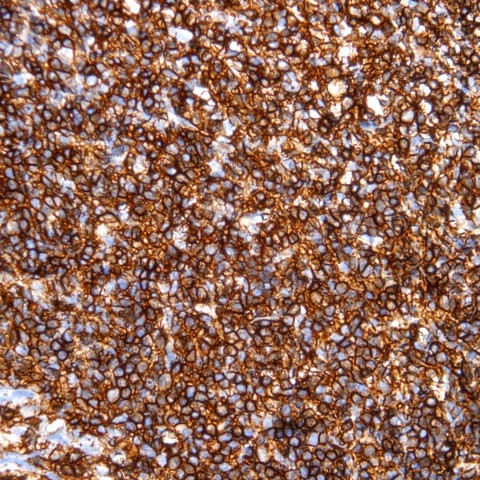 CD45 (Leukocyte common antigen, LCA) Antibody in Immunohistochemistry (Paraffin) (IHC (P))