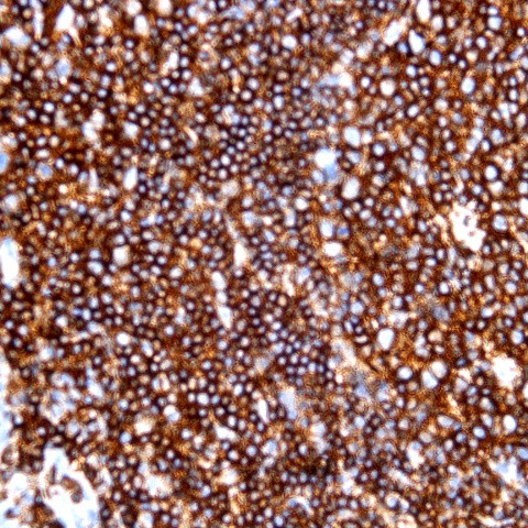 CD45 (Leukocyte common antigen, LCA) Antibody in Immunohistochemistry (Paraffin) (IHC (P))