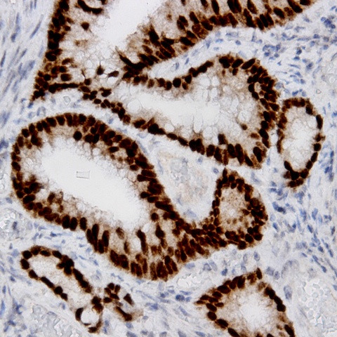 Estrogen Receptor, alpha (ER alpha) Antibody in Immunohistochemistry (Paraffin) (IHC (P))