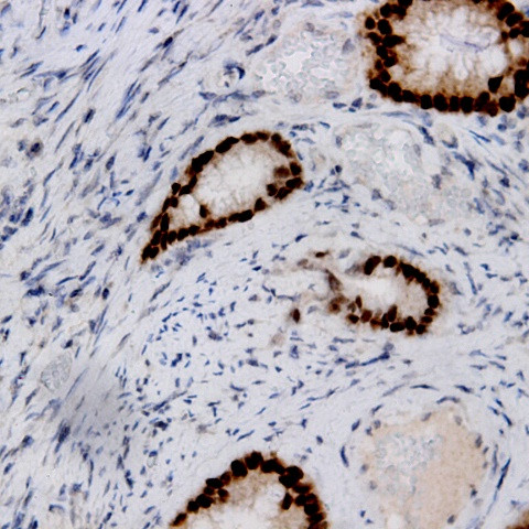 Estrogen Receptor, beta (ER beta) Antibody in Immunohistochemistry (Paraffin) (IHC (P))