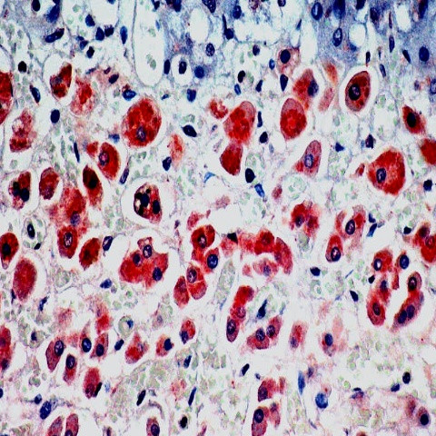 Multi-Drug Resistance Marker (P-Glycoprotein) Antibody in Immunohistochemistry (Paraffin) (IHC (P))