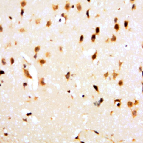 Cocaine Antibody in Immunohistochemistry (Paraffin) (IHC (P))