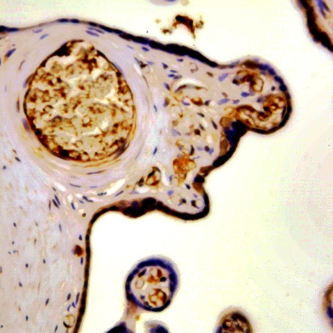 hCG b-subunit Antibody in Immunohistochemistry (Paraffin) (IHC (P))