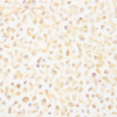 HIV, p18 Antibody in Immunocytochemistry (ICC/IF)