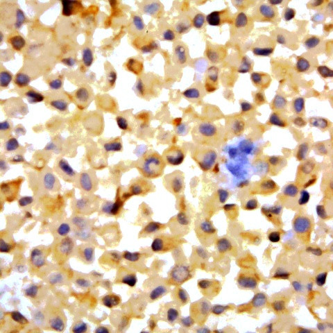 HIVgp160, gp120, gp41 Antibody in Immunohistochemistry (Paraffin) (IHC (P))