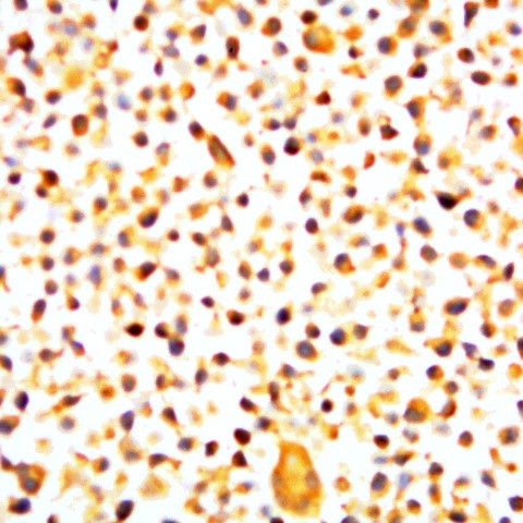 HIVgp160, gp120, gp41 Antibody in Immunohistochemistry (Paraffin) (IHC (P))