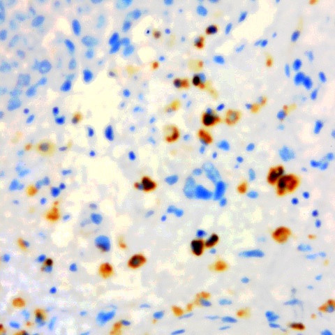 Morphine Antibody in Immunohistochemistry (Paraffin) (IHC (P))